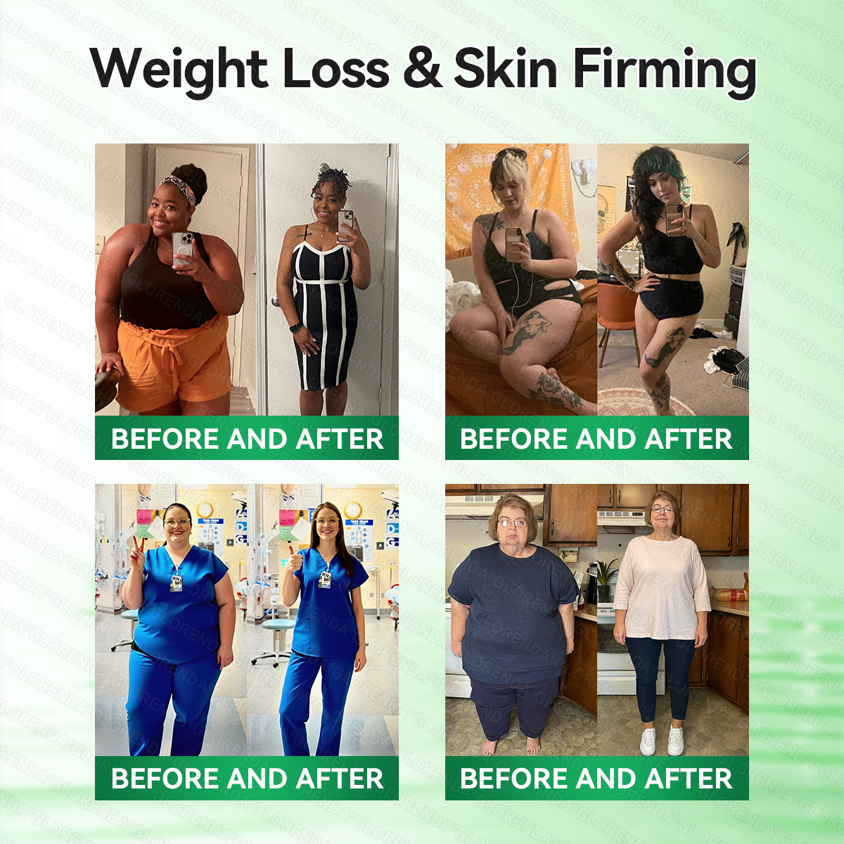 𝑶𝒇𝒇𝒊𝒄𝒊𝒂𝒍 𝑺𝒕𝒐𝒓𝒆  |👩‍⚕💚𝐆𝐋𝐎𝑹𝑬𝑵𝑫𝗔®𝑴𝒐𝒓𝒊𝒏𝒈𝗮 · 𝗕𝗲𝗿𝗯𝗲𝗿𝙞𝙣𝙚 × 𝙉𝘼𝐃+ 𝟏𝟎-𝐢𝐧-𝟏 𝗔𝗱𝘃𝗮𝗻𝗰𝙚𝙙 𝙉𝙖𝙣𝙤 𝙈𝙞𝙘𝙧𝙤𝙣𝙚𝙚𝐝𝐥𝐞 𝐏𝐚𝐭𝙘𝙝(𝐉𝐮𝐬𝐭 𝐨𝐧𝐜𝐞 𝐚 𝐝𝐚𝐲, 𝐯𝐢𝐬𝐢𝐛𝐥𝐞 𝐜𝐡𝐚𝐧𝐠𝐞𝐬 𝐢𝐧 𝟕 𝐝𝐚𝐲𝐬） ✅ 𝐅𝐨𝐫 𝐨𝐛𝐞𝐬𝐢𝐭𝐲, 🅛🅞🅞🅢🅔 🅢🅚🅘🅝,𝐝𝐢𝐚𝐛𝐞𝐭𝐞𝐬, 𝐬𝐥𝐞𝐞𝐩 𝐚𝐩𝐧𝐞𝐚, 𝐣𝐨𝐢𝐧𝐭 𝐢𝐬𝐬𝐮𝐞𝐬, 𝐚𝐧𝐝 𝐦𝐨𝐫𝐞🎁