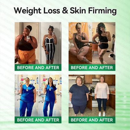 𝑶𝒇𝒇𝒊𝒄𝒊𝒂𝒍 𝑺𝒕𝒐𝒓𝒆  |👩‍⚕💚𝐆𝐋𝐎𝑹𝑬𝑵𝑫𝗔®𝑴𝒐𝒓𝒊𝒏𝒈𝗮 · 𝗕𝗲𝗿𝗯𝗲𝗿𝙞𝙣𝙚 × 𝙉𝘼𝐃+ 𝟏𝟎-𝐢𝐧-𝟏 𝗔𝗱𝘃𝗮𝗻𝗰𝙚𝙙 𝙉𝙖𝙣𝙤 𝙈𝙞𝙘𝙧𝙤𝙣𝙚𝙚𝐝𝐥𝐞 𝐏𝐚𝐭𝙘𝙝(𝐉𝐮𝐬𝐭 𝐨𝐧𝐜𝐞 𝐚 𝐝𝐚𝐲, 𝐯𝐢𝐬𝐢𝐛𝐥𝐞 𝐜𝐡𝐚𝐧𝐠𝐞𝐬 𝐢𝐧 𝟕 𝐝𝐚𝐲𝐬） ✅ 𝐅𝐨𝐫 𝐨𝐛𝐞𝐬𝐢𝐭𝐲, 🅛🅞🅞🅢🅔 🅢🅚🅘🅝,𝐝𝐢𝐚𝐛𝐞𝐭𝐞𝐬, 𝐬𝐥𝐞𝐞𝐩 𝐚𝐩𝐧𝐞𝐚, 𝐣𝐨𝐢𝐧𝐭 𝐢𝐬𝐬𝐮𝐞𝐬, 𝐚𝐧𝐝 𝐦𝐨𝐫𝐞🎁